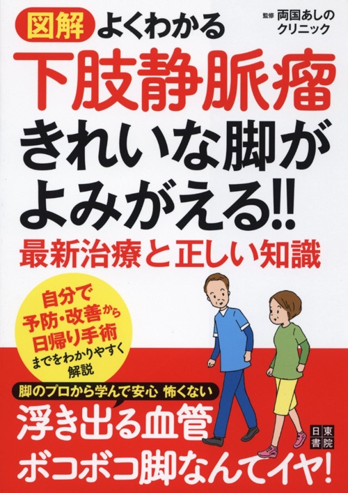 解 よくわかる下肢静脈瘤 きれいな足がよみがえる!! 最新治療と正しい知識