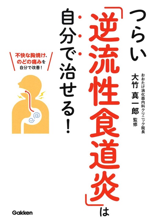 つらい「逆流性食道炎」は自分で治せる! 