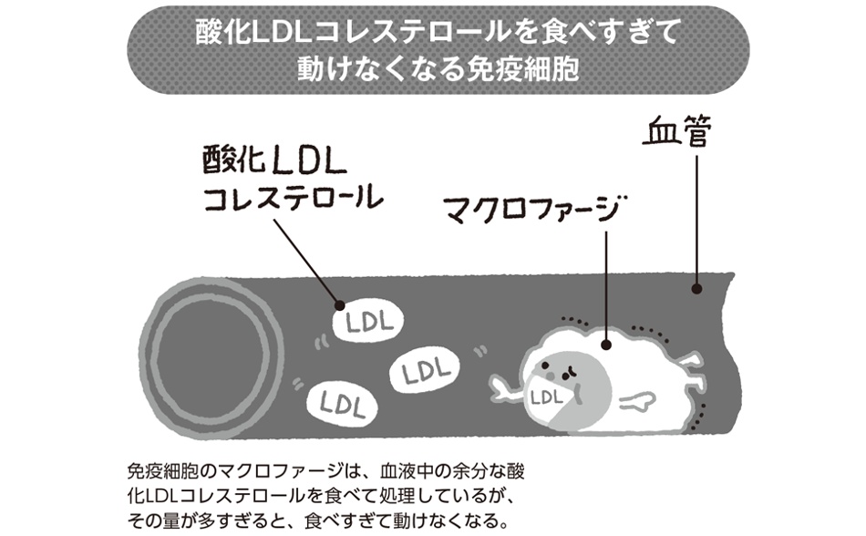 マクロファージ